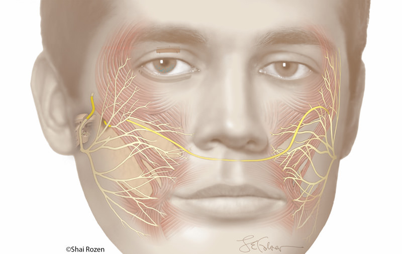 Different nerve reconstruction techniques