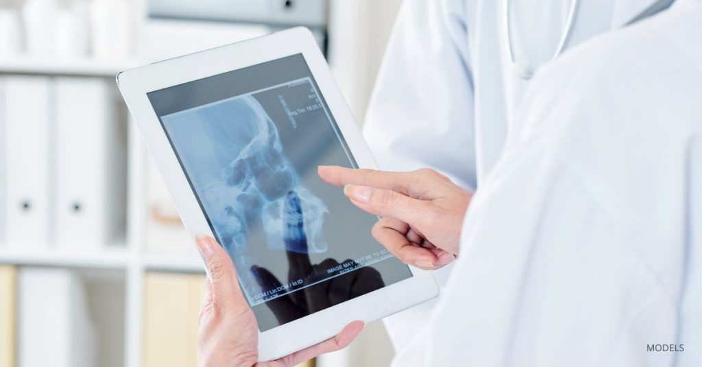 Pair of doctors (models) examining an x-ray of a patient's skull.